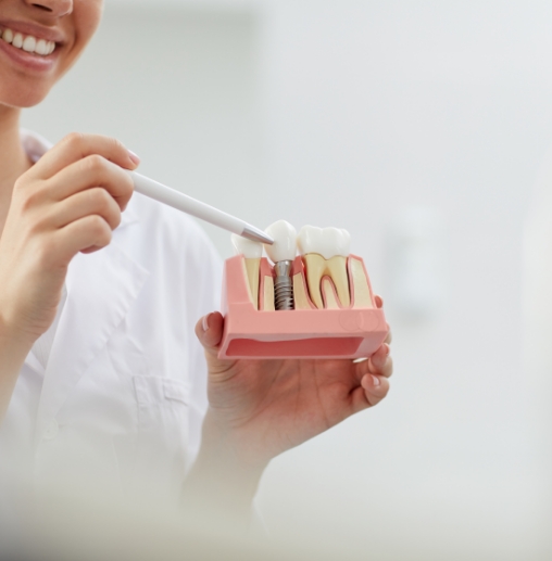 Dentist showing a patient a model of dental implants in Colorado Springs