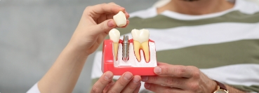 Hand placing a dental crown on a model of a dental implant