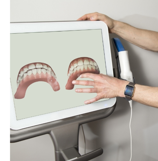 Dentist gesturing to digital models of teeth on computer monitor