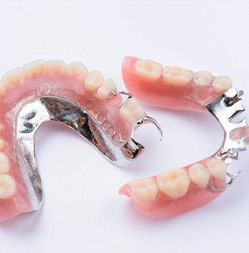 Partial dentures are ideal for patients missing some but not all of the teeth on an arch