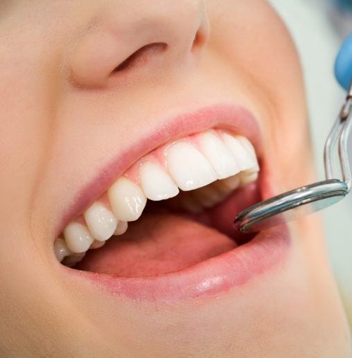Close up of mouth receiving a preventive dentistry checkup